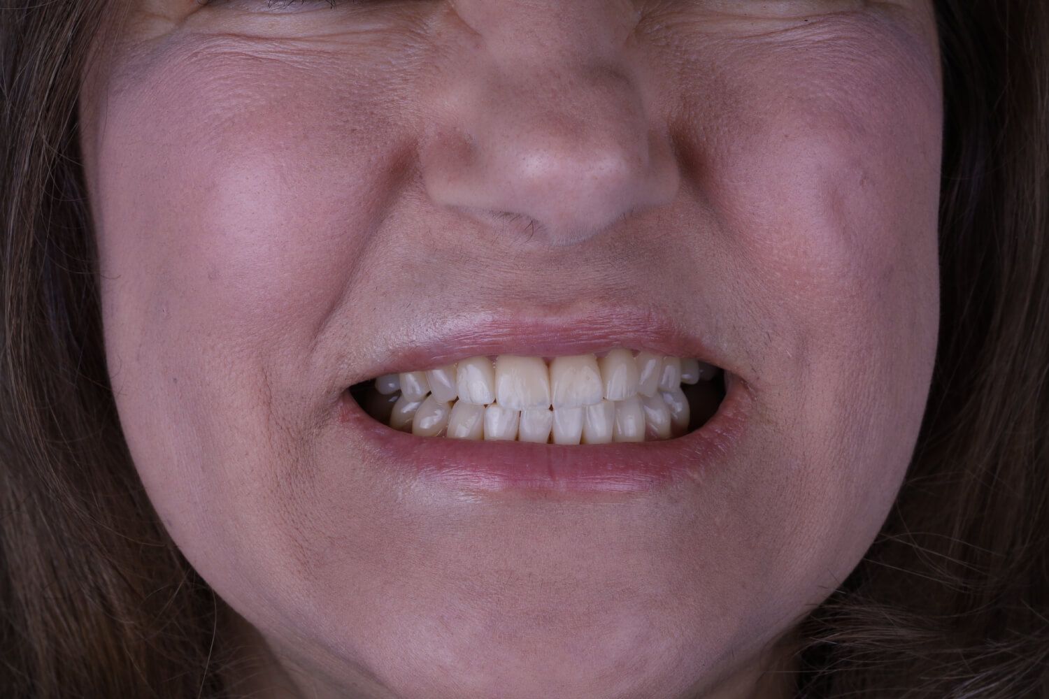 SureSmile Clear Aligners The Art of Dentistry